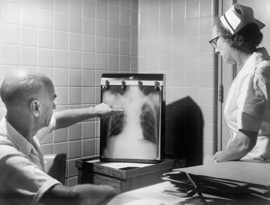 A physician showing a patient a lung x-ray and the effects of air pollution
